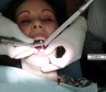 Mulher usando broca de dentista é a foto que ilustra a nota do Fernando Albrecht sobre medo de brocas